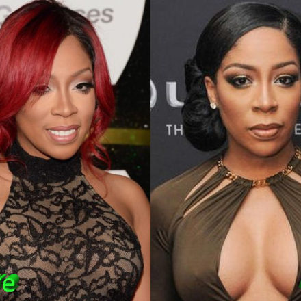 K Michelle Plastic Surgery Speculations