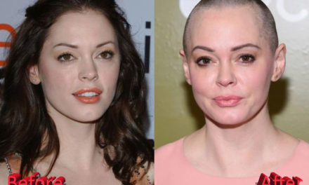 Rose McGowan Plastic Surgery: A Necessary Move