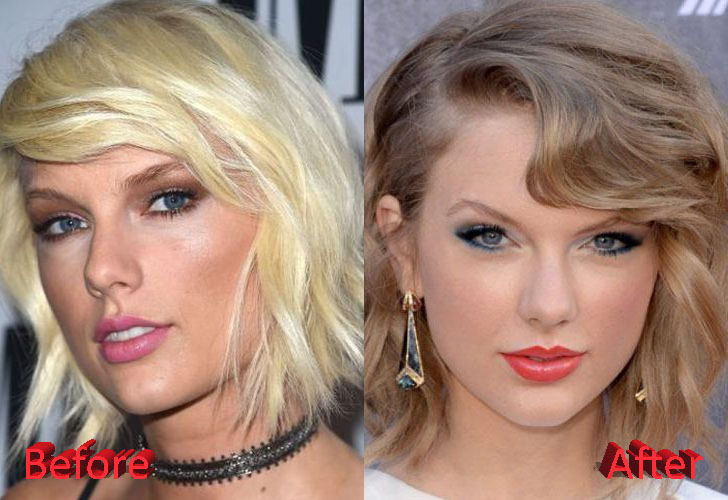 Taylor Swift Plastic Surgery Before And After