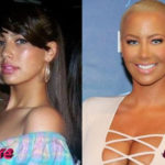 Amber Rose before and after surgery