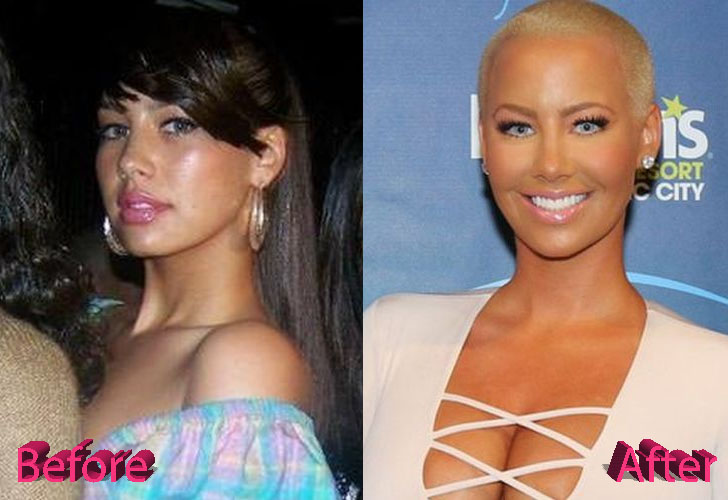 Amber Rose Plastic Surgery: A Lift Here and There