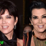 Kris Jenner Before and After Facelift Procedure