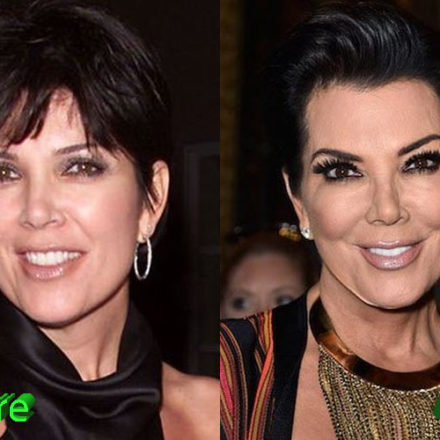 Kris Jenner Plastic Surgery: A Really Beautiful Granny