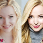 Dove Cameron Plastic Surgery Before and After