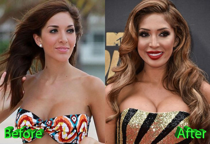 Farrah Abraham Plastic Surgery: Farrah’s Many Changes