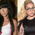 Lady Gaga Before and After Cosmetic Surgery 150x150