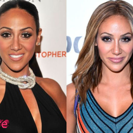 Melissa Gorga Plastic Surgery Before and After Review