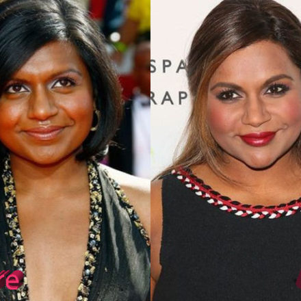 Mindy Kaling Plastic Surgery: A Project Done Well