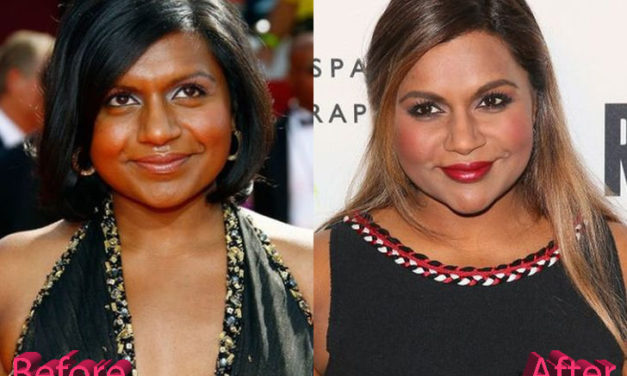 Mindy Kaling Plastic Surgery: A Project Done Well