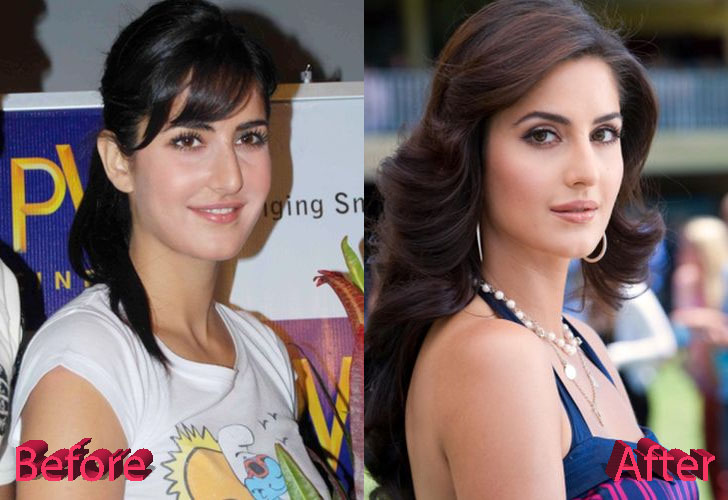 Katrina Kaif Plastic Surgery: New Look For Katrina