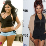 Snooki Plastic Surgery Before and After