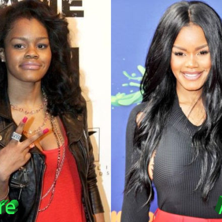 Teyana Taylor Plastic Surgery: New Look For R&B Beauty