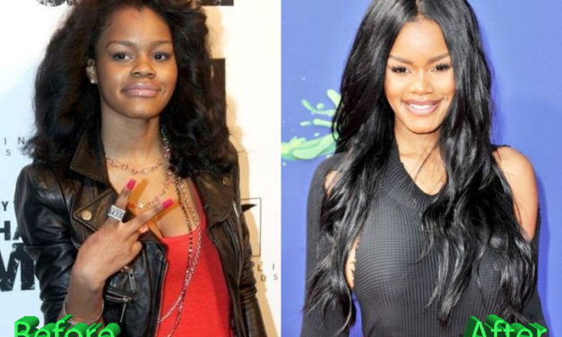 Teyana Taylor Plastic Surgery: New Look For R&B Beauty