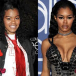 Teyana Taylor Plastic Surgery Before and After 150x150