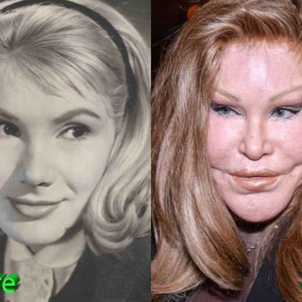 Catwoman The Plastic Surgery That Sparked A Global Obsession And The Experts React - 4jt48bn