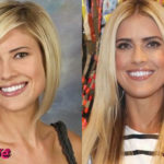 Christina El Moussa Before and After Surgery Procedure