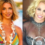 Britney Spears Before and After Cosmetic Surgery 150x150