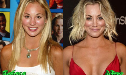 Kaley Cuoco Plastic Surgery: An Example to Follow?