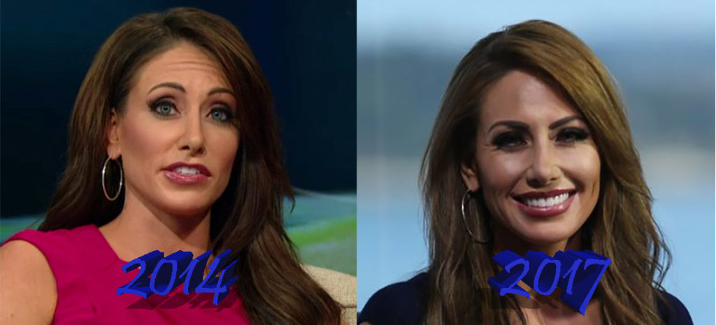 Holly Sonders plastic surgery: Gold player turns into TV beauty