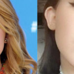 Noah Cyrus before and after lip implants