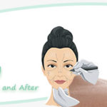 CelebrityAfterPlasticSurgery