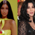 Cher before and after plastic surgery