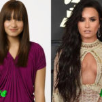 Demi Lovato Before and After Cosmetic Surgery