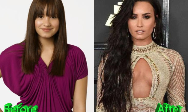 Demi Lovato Plastic Surgery: An Improvement For A Young Star