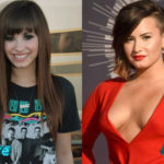 Demi Lovato Before and After Plastic Surgery 150x150