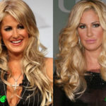 Kim Zolciak Before and After Cosmetic Surgery