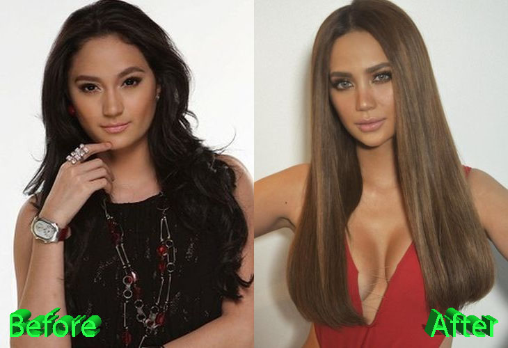Arci Munoz Plastic Surgery: Win or Fail For a Young Star?