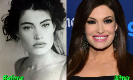 Kimberly Guilfoyle Plastic Surgery: A New Youth For News Anchor