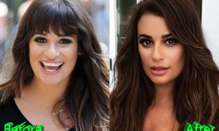 Lea Michele Nose Job: Rumors And Allegations About It