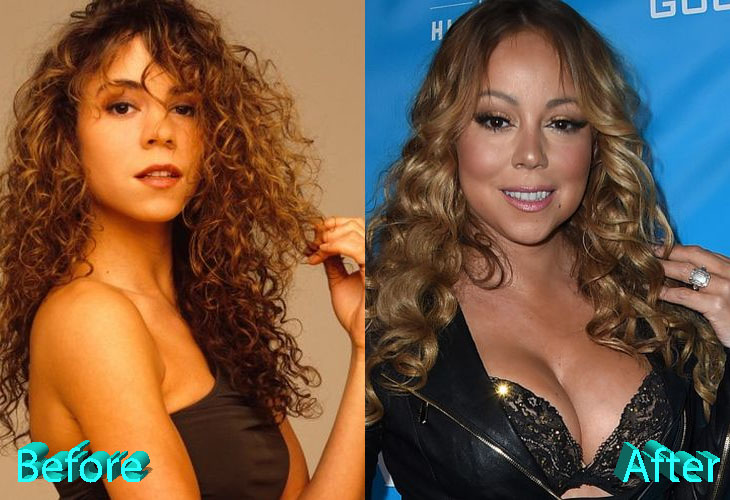 Mariah Carey Plastic Surgery: Has Mariah Found A Youth Fountain?