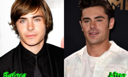Zac Efron Plastic Surgery: A New Look For Teen Heartthrob