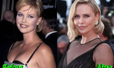 Charlize Theron Plastic Surgery Rumors: True or Just Good Genes