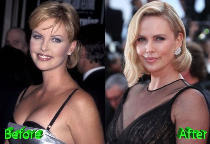 Charlize Theron Plastic Surgery Rumors: True or Just Good Genes