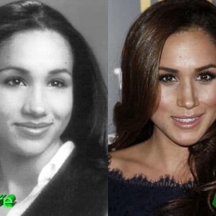 Meghan Markle Nose Job: A Look For The Princess To Be