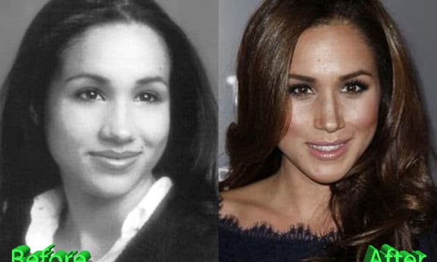 Meghan Markle Nose Job: A Look For The Princess To Be