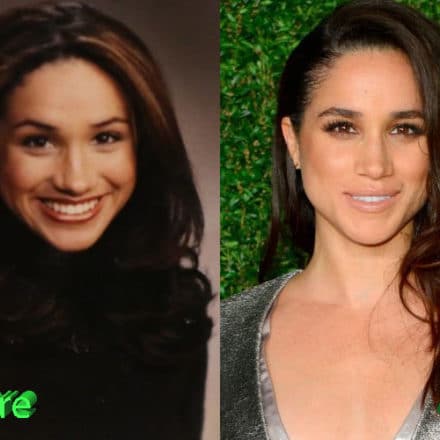 Meghan Markle Nose Job: A Look For The Princess To Be