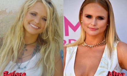 Miranda Lambert Plastic Surgery: More Than Just A Diet