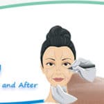 celebrityplasticsurgery