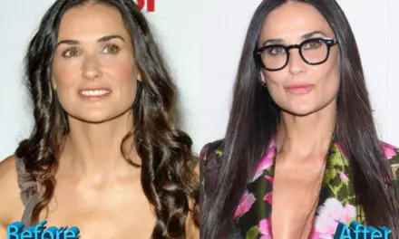 Demi Moore Plastic Surgery: All Natural, Really, Demi?