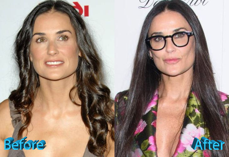 Demi Moore Plastic Surgery: All Natural, Really, Demi?