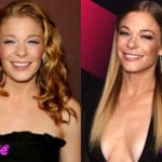 Leann Rimes Before and After Cosmetic Surgery