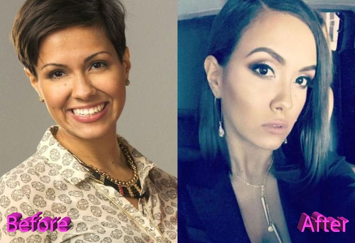 Briana Dejesus Plastic Surgery Rumors Explained How And Why