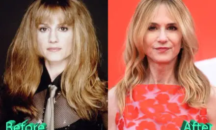 Holly Hunter Plastic Surgery : The Latest Talk Of The Town