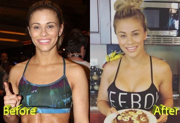 Paige Vanzant Before and After Boob Job