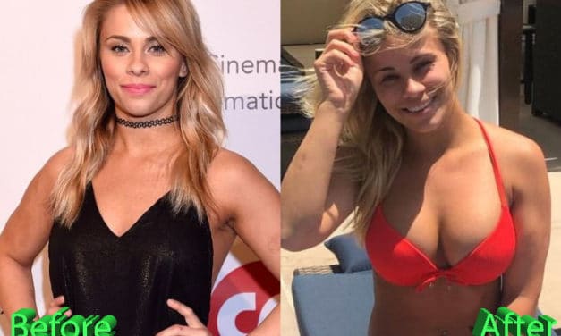 Paige Vanzant Boob Job: A Rumor Confirmed By Paige Herself